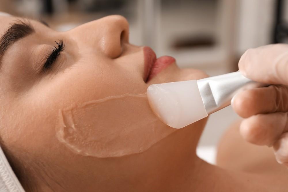 Chemical Peels